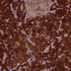 RNASEK Antibody, Novus Biologicals 0.1mL; Unlabeled:Antibodies, Polyclonal