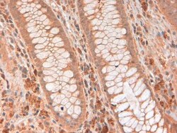 RNase L Antibody (2E9) - BSA Free, Novus Biologicals:Antibodies:Primary