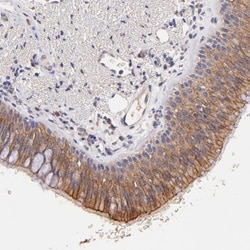 RNase L Antibody, Novus Biologicals:Antibodies:Primary Antibodies