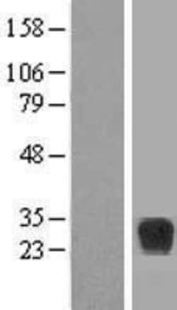 Novus Biologicals&trade;&nbsp;RND2 Overexpression Lysate