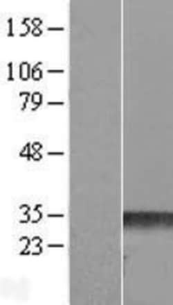 Novus Biologicals&trade;&nbsp;RND3 Overexpression Lysate