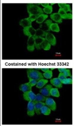 RNF10 Antibody, Novus Biologicals 0.1mL; Unlabeled:Anticuerpos
