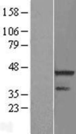 Novus Biologicals&trade;&nbsp;RNF113A Overexpression Lysate