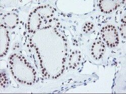 RNF113B Antibody (OTI7A1), Novus Biologicals 0.1mL; Unlabeled:Antibodies,