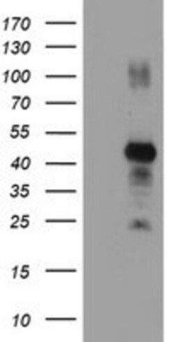 RNF113B Antibody (OTI7A1), Novus Biologicals 0.1mL; Unlabeled:Antibodies,