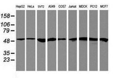 RNF113B Antibody (OTI7A1), Novus Biologicals 0.1mL; Unlabeled:Antibodies,