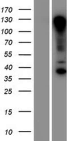 Novus Biologicals&trade;&nbsp;RNF121 Overexpression Lysate