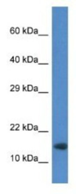 RNF122 Antibody, Novus Biologicals 100&mu;L; Unlabeled:Antibodies, Polyclonal