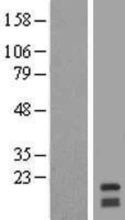 Novus Biologicals™ RNF122 Overexpression Lysate