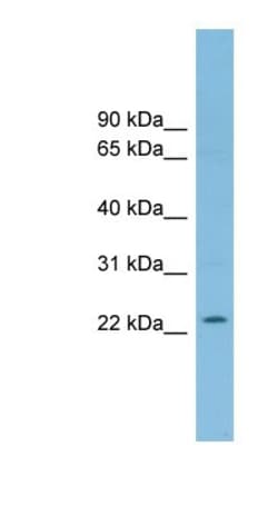 RNF125 Antibody, Novus Biologicals 100&mu;L; Unlabeled:Antibodies, Polyclonal