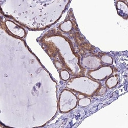 RNF126 Antibody, Novus Biologicals 0.1mL; Unlabeled:Antibodies, Polyclonal