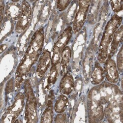 RNF130 Antibody, Novus Biologicals 0.1mL; Unlabeled:Antibodies, Polyclonal