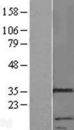 Novus Biologicals™ RNF133 Overexpression Lysate