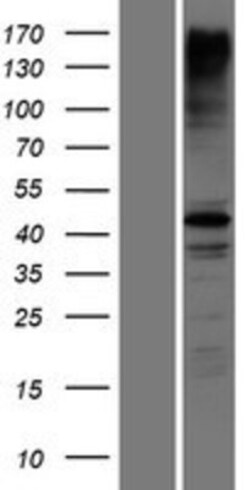 Novus Biologicals&trade;&nbsp;RNF135 Overexpression Lysate
