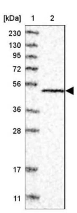 RNF135 Antibody, Novus Biologicals 25 &mu;L; Unlabeled:Antibodies, Polyclonal