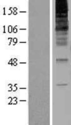 Novus Biologicals&trade;&nbsp;RNF139 Overexpression Lysate