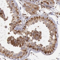 RNF139 Antibody, Novus Biologicals 25 &mu;L; Unlabeled:Antibodies, Polyclonal