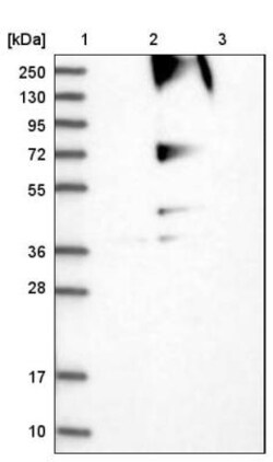 RNF139 Antibody, Novus Biologicals 25 &mu;L; Unlabeled:Antibodies, Polyclonal