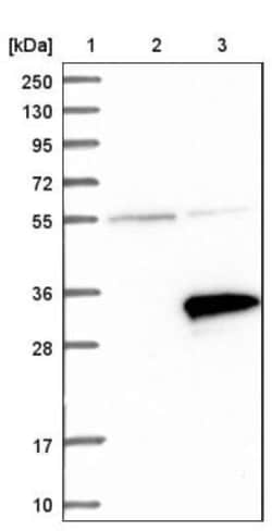 RNF141 Antibody, Novus Biologicals:Antibodies:Primary Antibodies