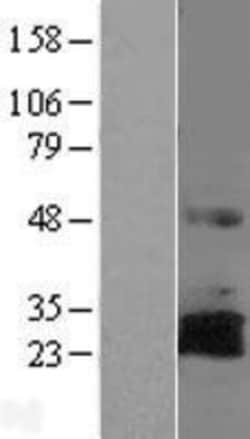 Novus Biologicals&trade;&nbsp;RNF144A Overexpression Lysate