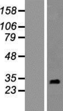 Novus Biologicals™ RNF151 Overexpression Lysate