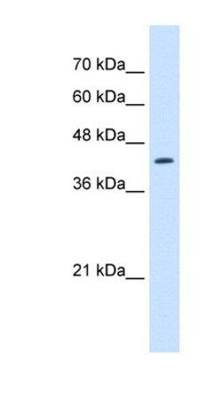 RNF165 Antibody, Novus Biologicals 100&mu;L; Unlabeled:Antibodies, Polyclonal
