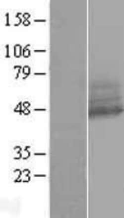 Novus Biologicals&trade;&nbsp;RNF167 Overexpression Lysate