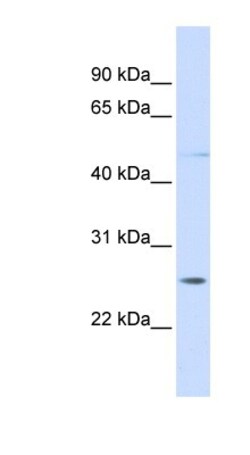 RNF170 Antibody, Novus Biologicals 20&mu;L; Unlabeled:Antibodies, Polyclonal