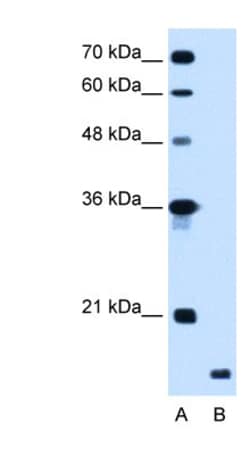 RNF175 Antibody, Novus Biologicals:Antibodies:Primary Antibodies