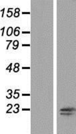 Novus Biologicals&trade;&nbsp;RNF181 Overexpression Lysate