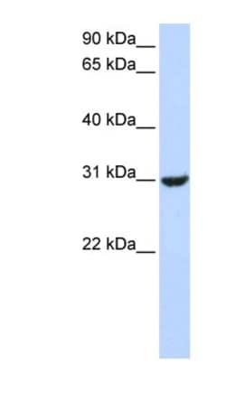 RNF182 Antibody, Novus Biologicals 20&mu;L; Unlabeled:Antibodies, Polyclonal