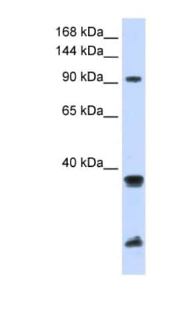 RNF20 Antibody, Novus Biologicals:Antibodies:Primary Antibodies