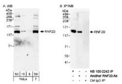 RNF20 Antibody, Novus Biologicals 0.1mL; Unlabeled:Antibodies, Polyclonal