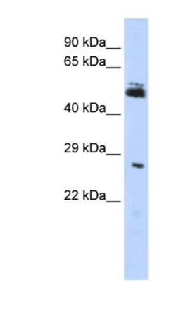 RNF212 Antibody, Novus Biologicals:Antibodies:Primary Antibodies