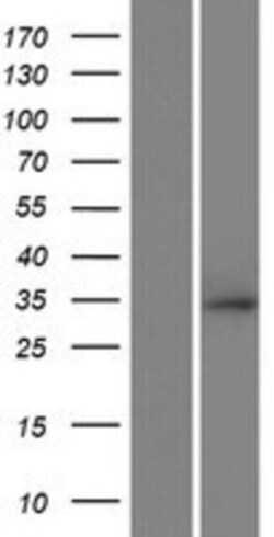 Novus Biologicals&trade;&nbsp;RNF212 Overexpression Lysate