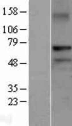 Novus Biologicals&trade;&nbsp;RNF220 Overexpression Lysate