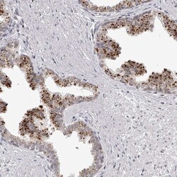RNF220 Antibody, Novus Biologicals 0.1mL; Unlabeled:Antibodies, Polyclonal