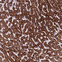 RNF222 Antibody, Novus Biologicals 25 &mu;L, Unlabeled:Antibodies, Polyclonal