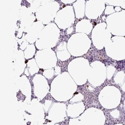 RNF23 Antibody, Novus Biologicals 0.1mL; Unlabeled:Antibodies, Polyclonal