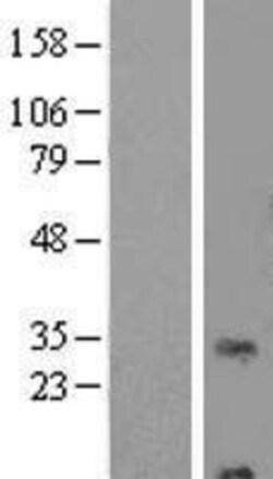 Novus Biologicals&trade;&nbsp;RNF24 Overexpression Lysate