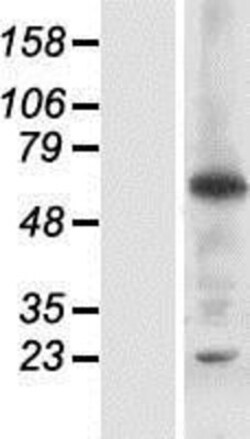 Novus Biologicals&trade;&nbsp;RNF25 Overexpression Lysate