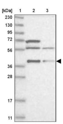 RNF2 Antibody, Novus Biologicals 0.1mL; Unlabeled:Antibodies, Polyclonal