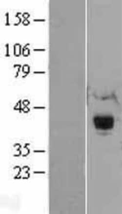 Novus Biologicals&trade;&nbsp;RNF34 Overexpression Lysate