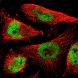 Hexim 1 Antibody, Novus Biologicals:Antibodies:Primary Antibodies
