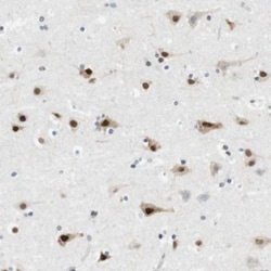 Hexim 1 Antibody, Novus Biologicals:Antibodies:Primary Antibodies