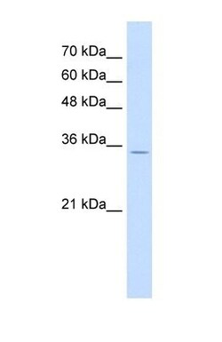 RNF39 Antibody, Novus Biologicals:Antibodies:Primary Antibodies