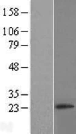 Novus Biologicals™ RNF4 Overexpression Lysate