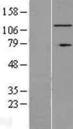 Novus Biologicals&trade;&nbsp;RNF40 Overexpression Lysate