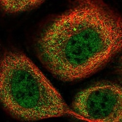 RNF40 Antibody, Novus Biologicals:Antibodies:Primary Antibodies