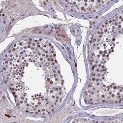RNF40 Antibody, Novus Biologicals:Antibodies:Primary Antibodies
